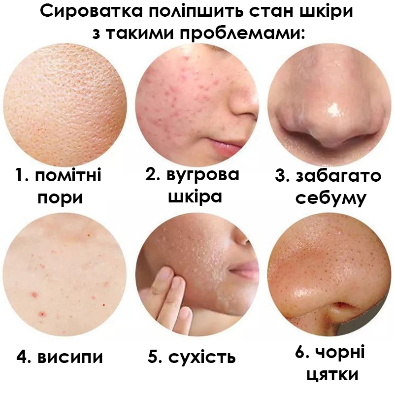 Сыворотка для лица SERSANLOVE Rice Essence 30 мл с экстрактом риса